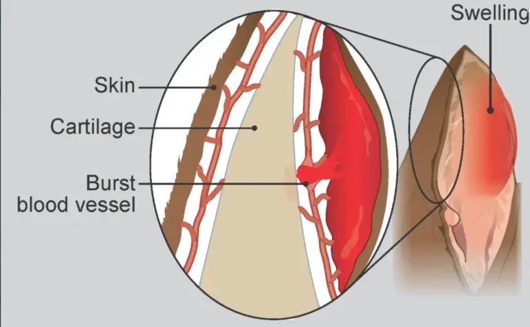 Blood trapped in the pinna surgery guidance from PetYaari Hyderabad
