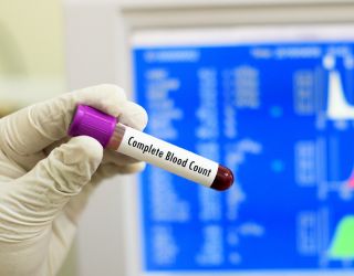 Complete Blood Count (CBC)