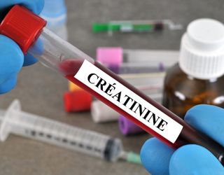 Creatinine, Serum