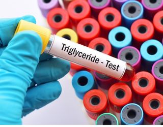 Triglycerides, Serum