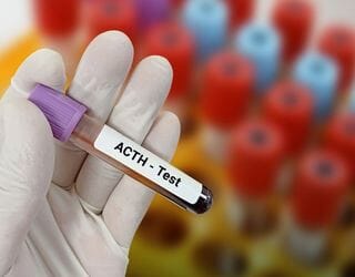 ACTH (Adrenocorticotropic Hormone)