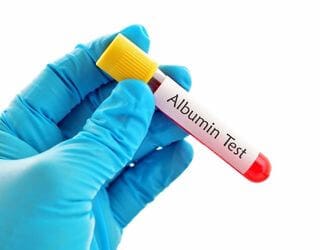 Albumin, Serum