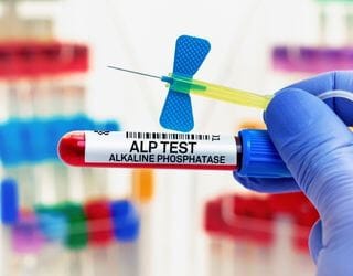 Alkaline Phosphatase (ALP)