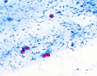 Blood Smear - Protozoa