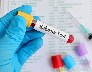 Canine Babesia Detection, PCR