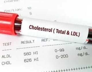 Cholesterol, Total