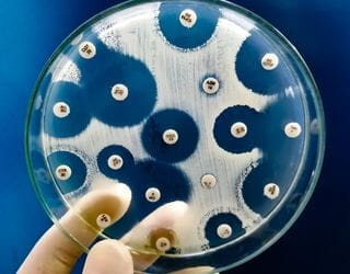 Culture Pus and Sensitivity