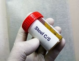 Culture Stool and Sensitivity