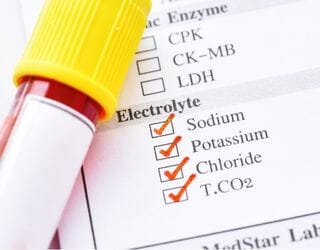 Electrolytes, Serum (Sodium, Potassium, Chloride)