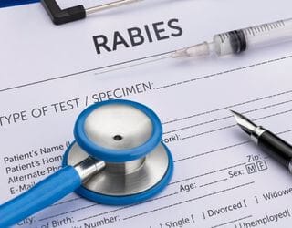FAVN TEST(RABIES ANTIBODY TITER) FOR OVERSEAS TRAVEL