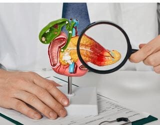 Feline Pancreatic Lipase (fPL)