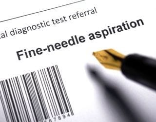 Fine Needle Aspiration Cytology (FNAC)