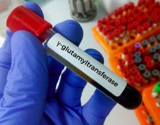 Gamma Glutamyl Transpeptidase (GGT)