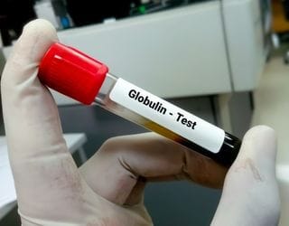 Globulin, Serum