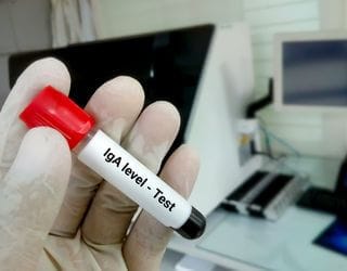 IgA Immunoglobulin, Serum