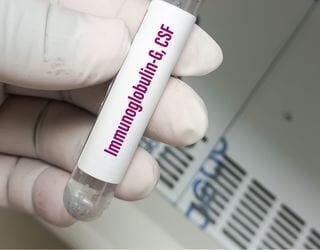 IgG Immunoglobulin, Serum