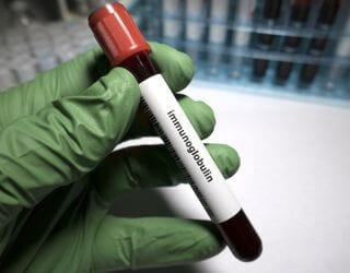 IgM Immunoglobulin, Serum