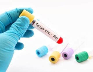 Iron, Serum