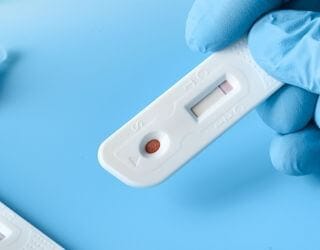 Leishmania Antibody IgG