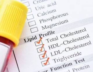 Lipid Profile