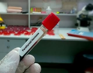 Parathyroid Hormone (PTH)