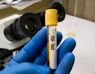 TSH (Thyroid-Stimulating Hormone)