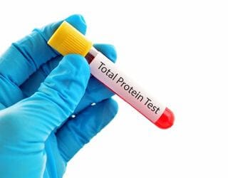 Total Protein, Serum