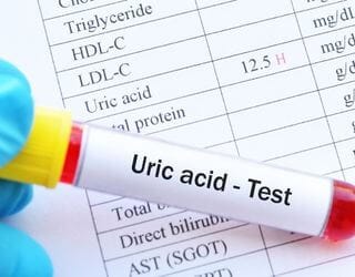 Uric Acid, Serum