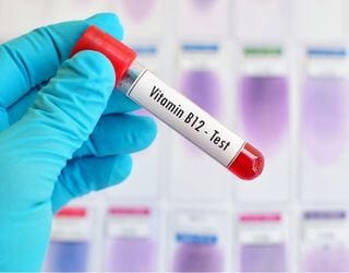 Vitamin B12 (Cyanocobalamin)