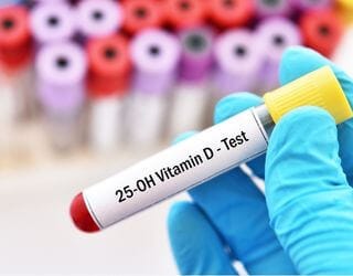 Vitamin D, 25 Hydroxy