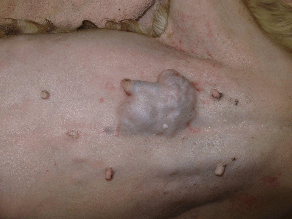 Single mammary tumor in dog