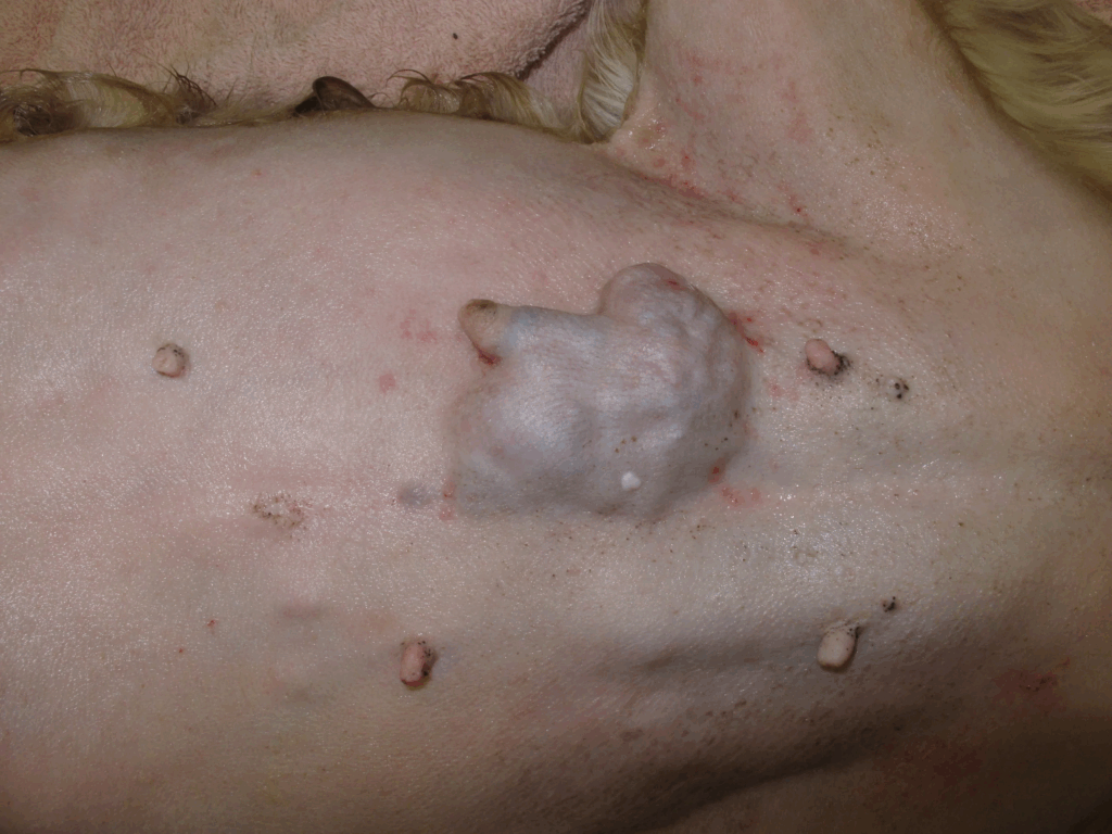 Single mammary tumor in dog