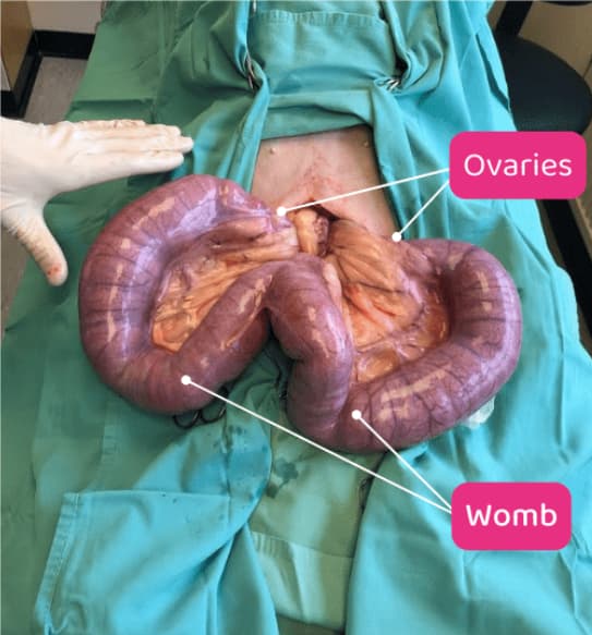 Pus Filled Uterus (Pyometra) in Dogs